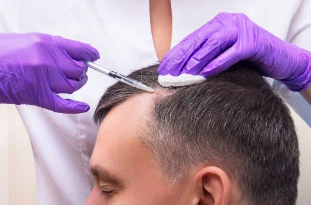 Beard & Hair Transplant Birmingham – Custom Solutions for You